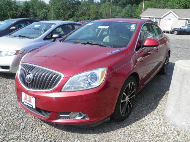 photo of 2016 Buick Verano Sport Touring Group
